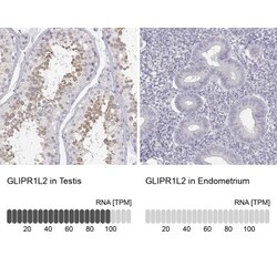 GLIPR1L2 Antibody, Novus Biologicals:Antibodies:Primary Antibodies